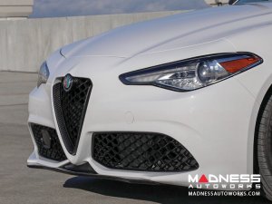 Alfa Romeo Giulia Front V Shield Grill Frame + Emblem Frame Kit - Carbon Fiber